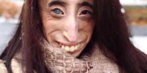 Lizzie Velasquez headshot