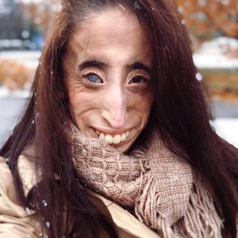 Lizzie Velasquez headshot